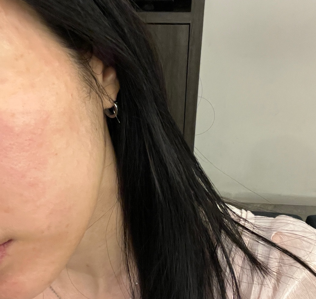 수술후기이미지