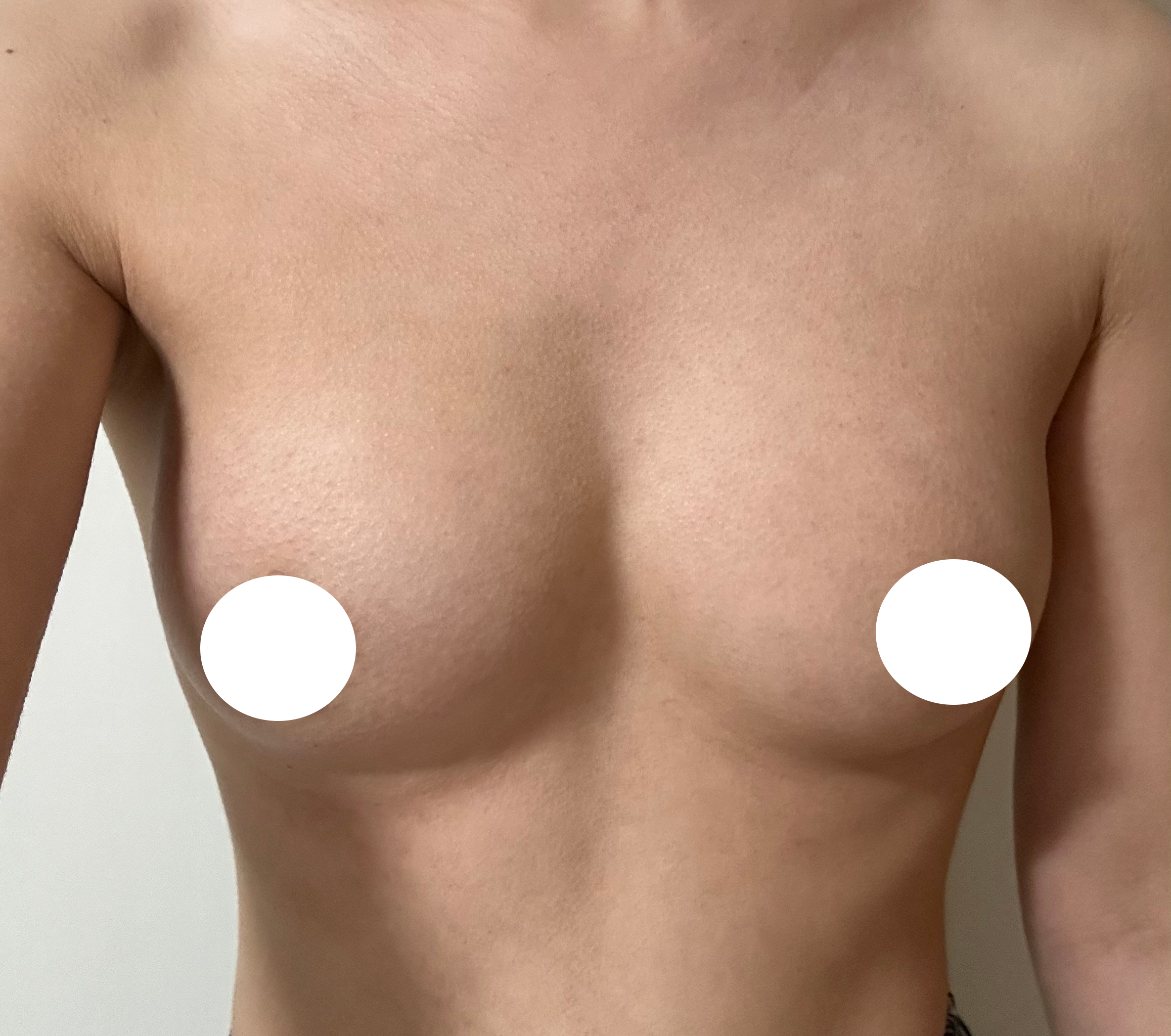 수술후기이미지