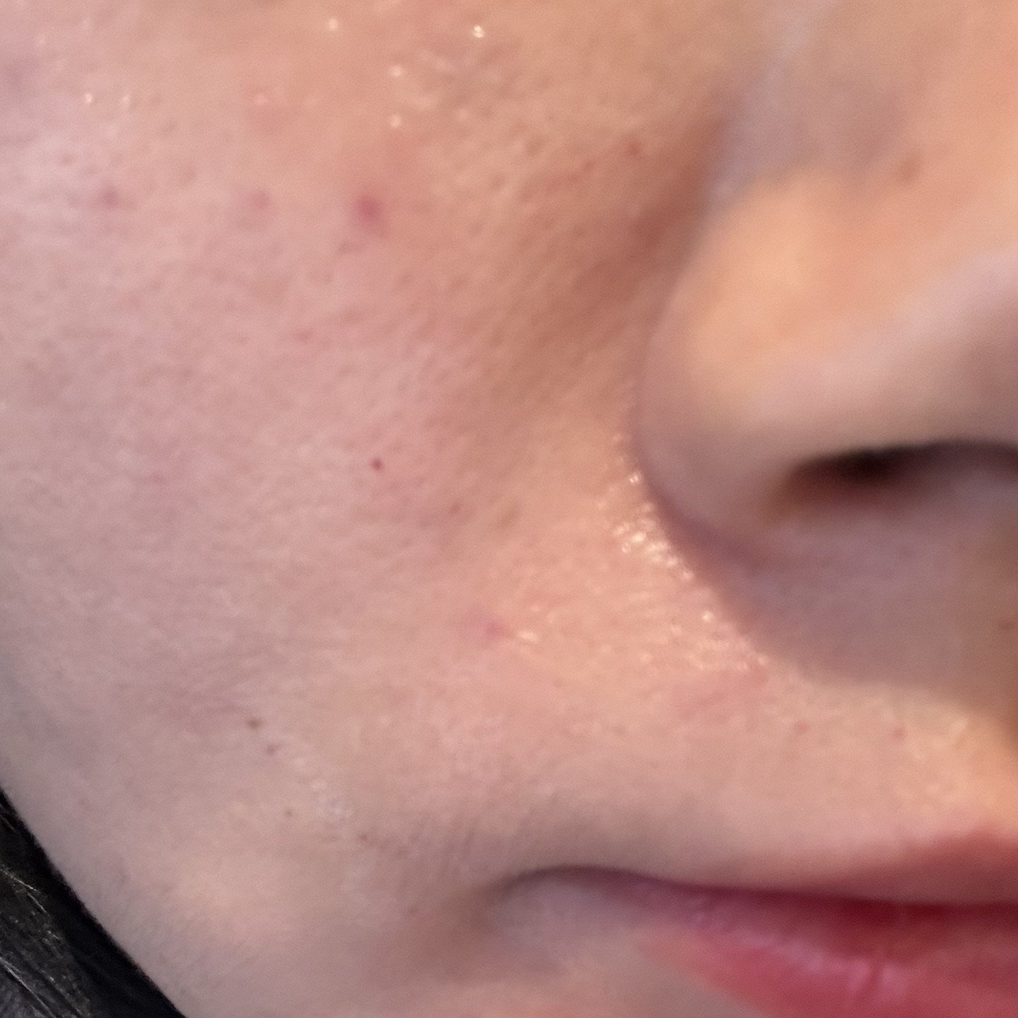 수술후기이미지