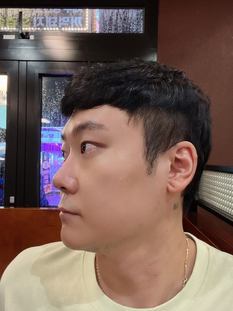 수술후기이미지