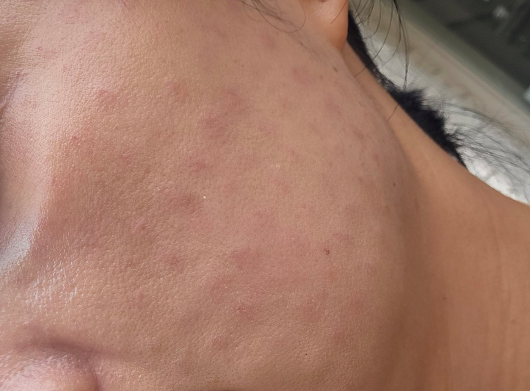 수술후기이미지