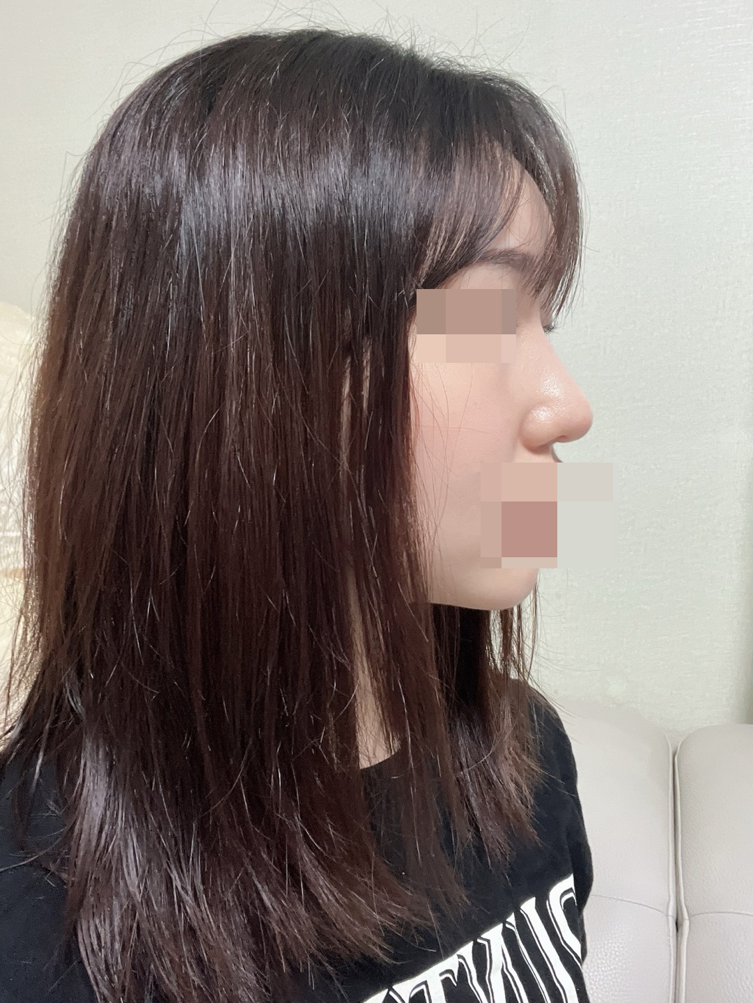 수술후기이미지