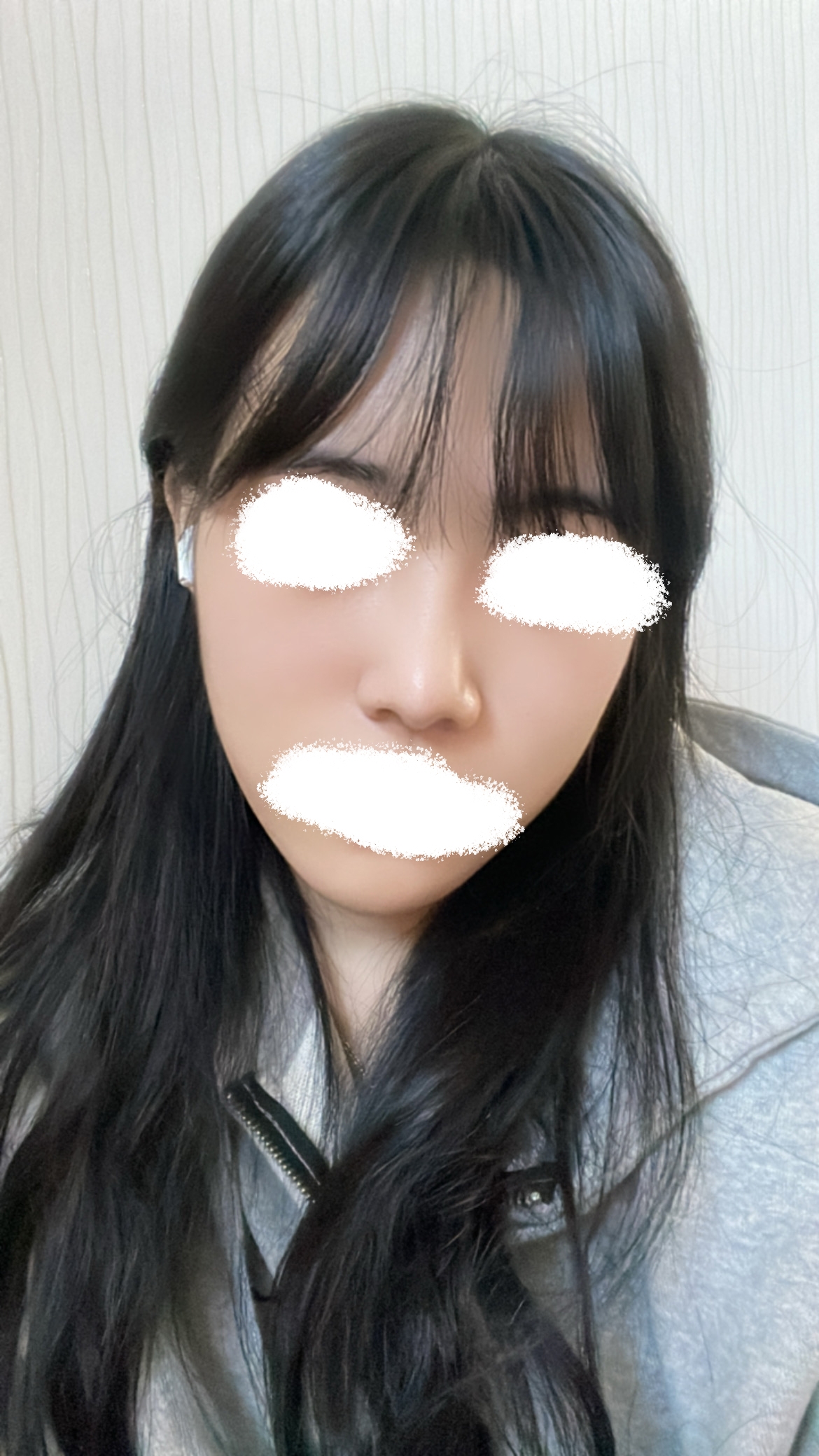 수술후기이미지