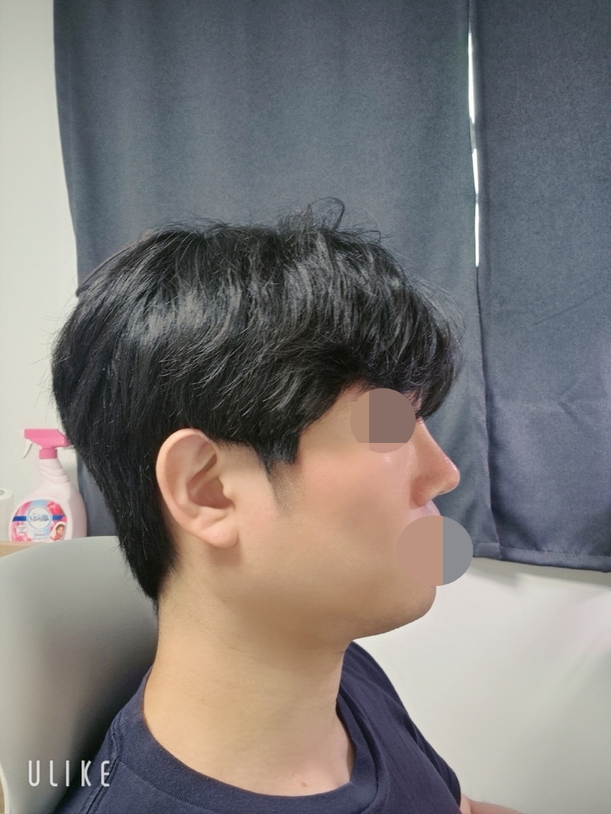 수술후기이미지