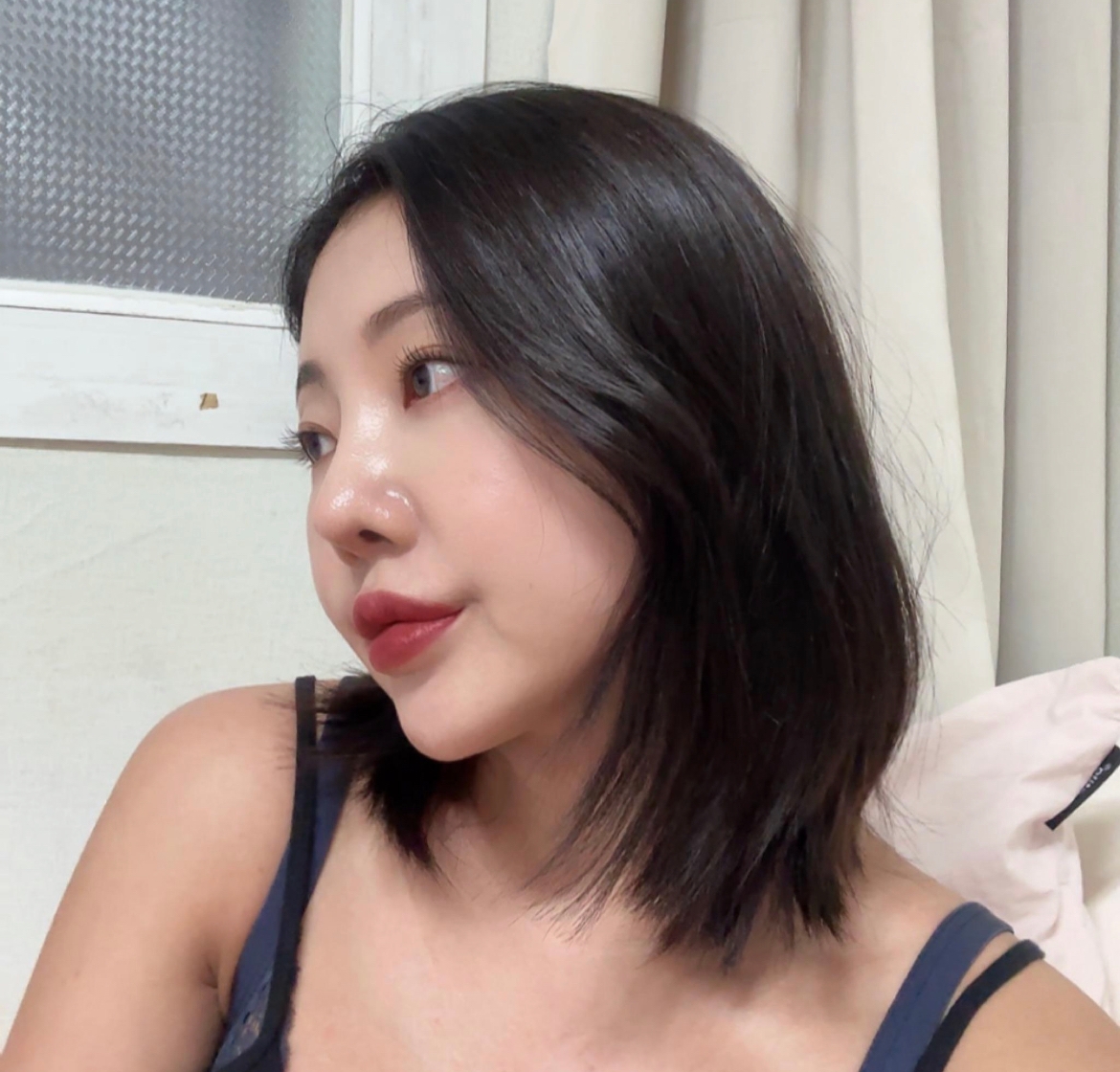 수술후기이미지