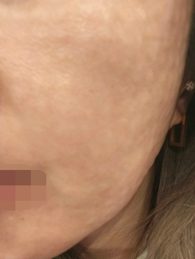 수술후기이미지