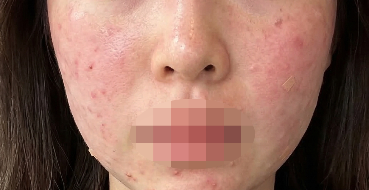 수술후기이미지