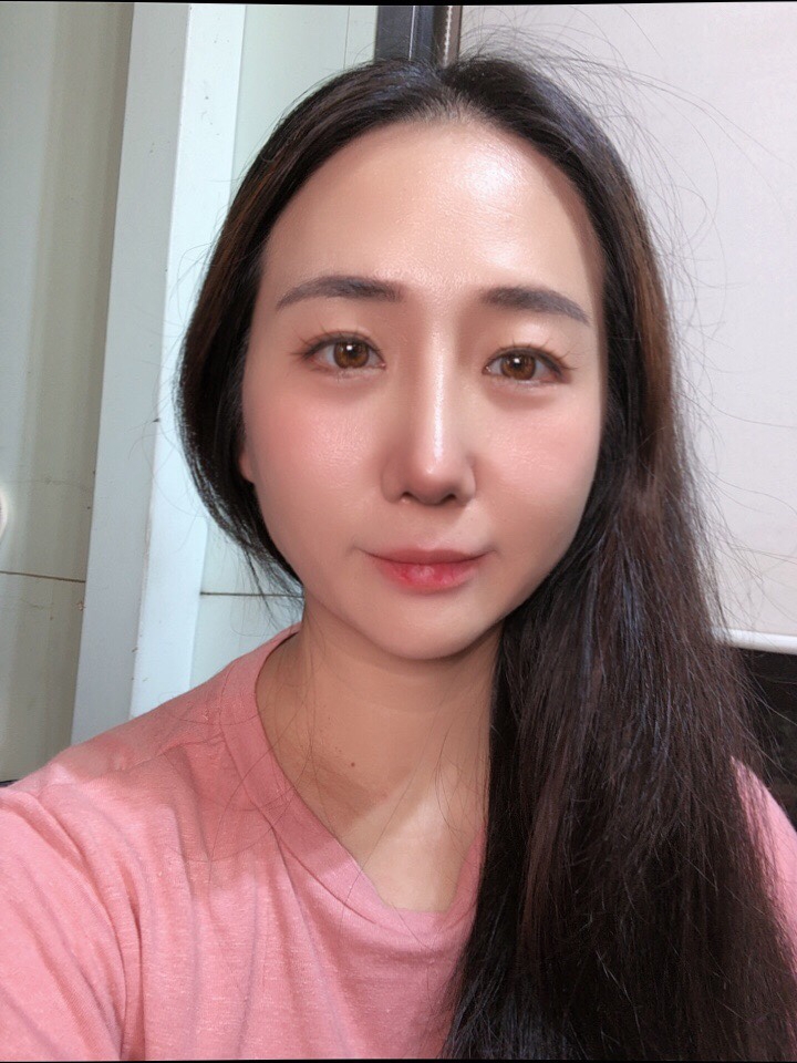 수술후기이미지