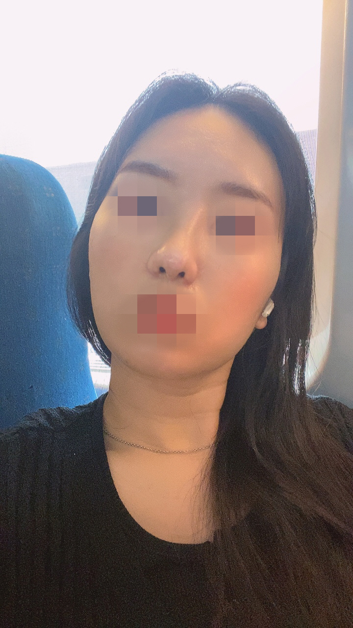 수술후기이미지