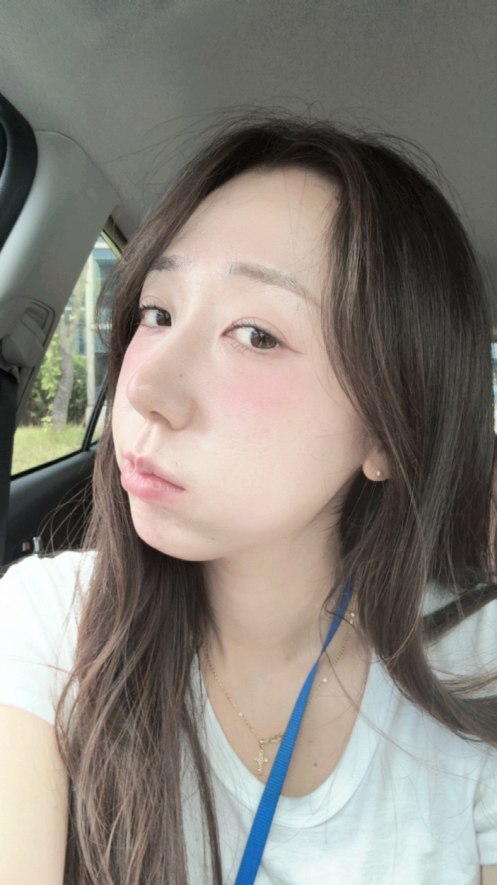 수술후기이미지