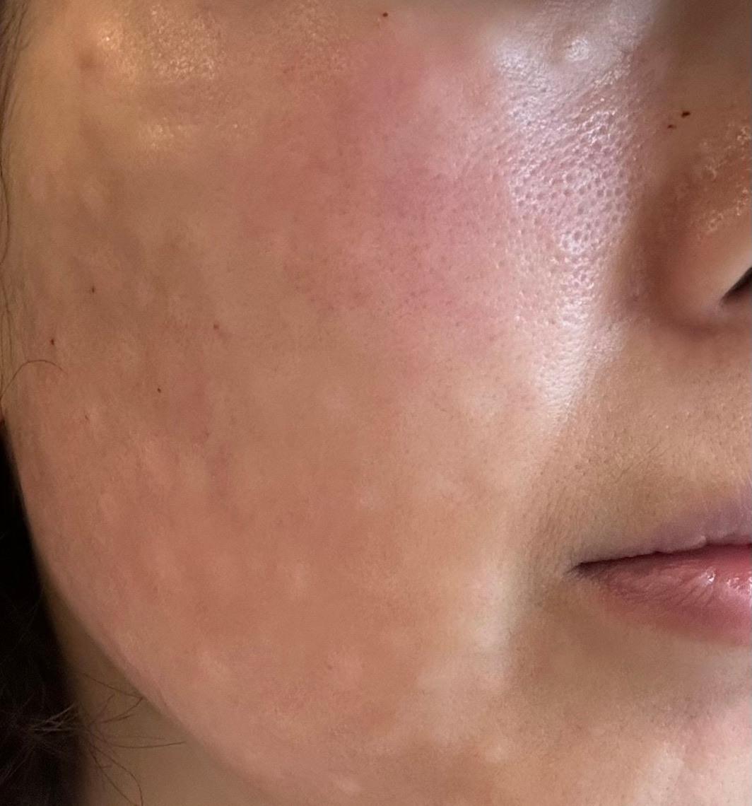 수술후기이미지