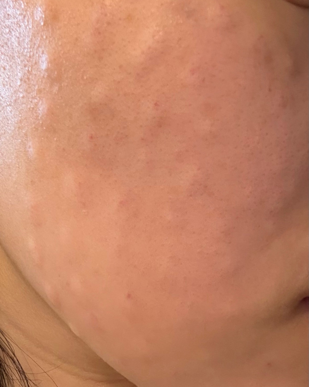 수술후기이미지