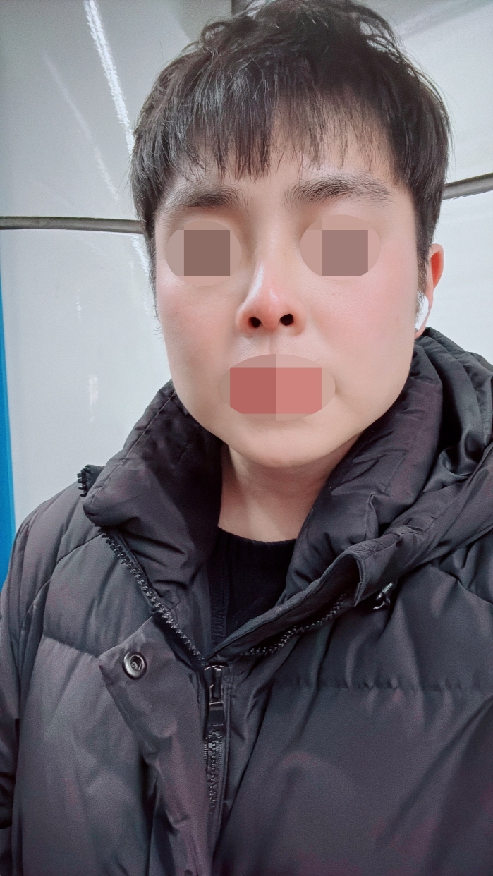 수술후기이미지