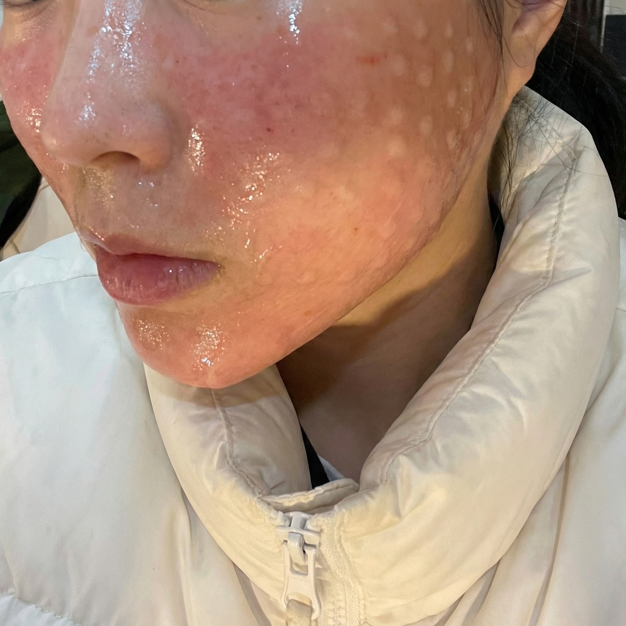 수술후기이미지