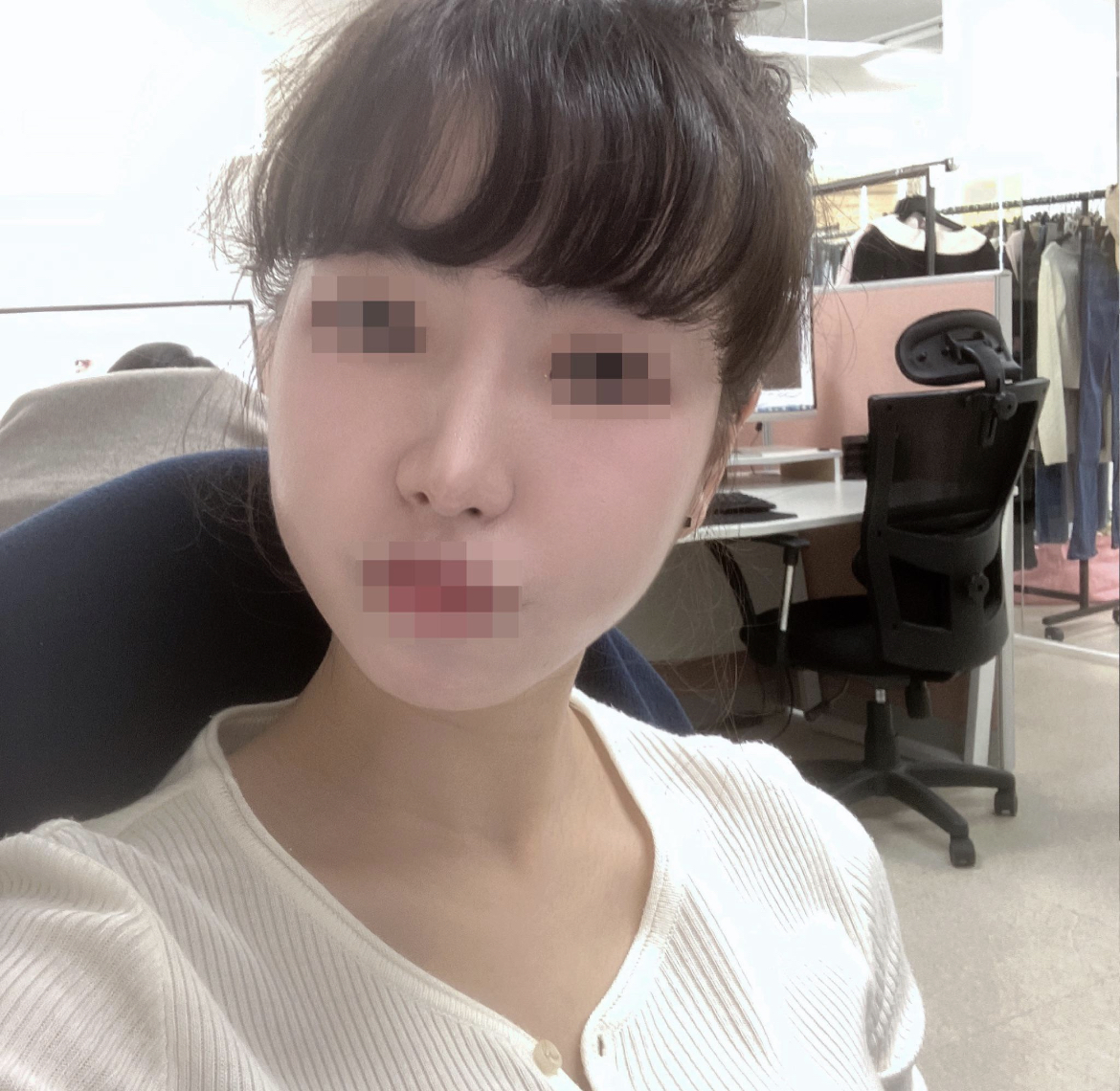 수술후기이미지