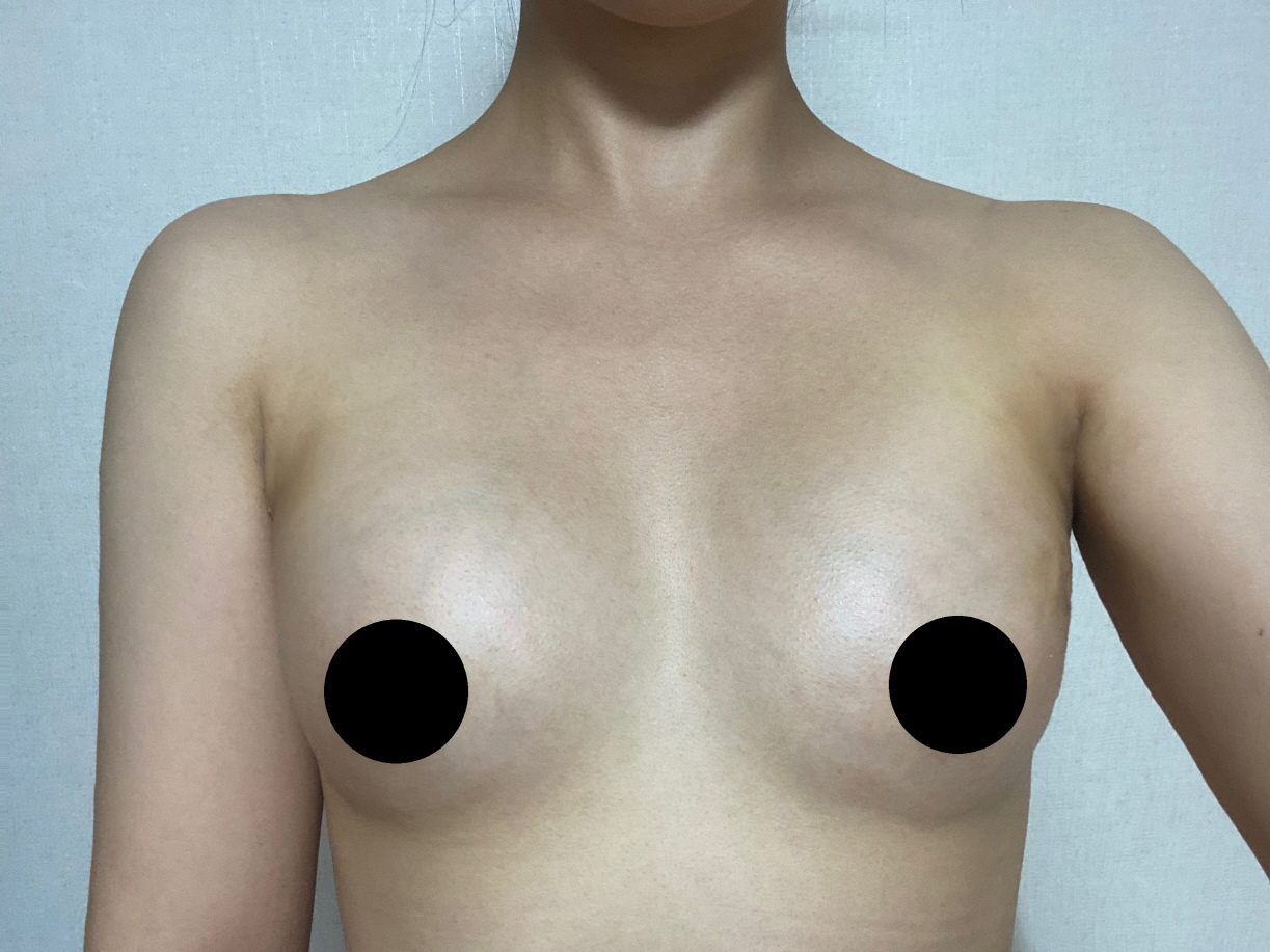 수술후기이미지