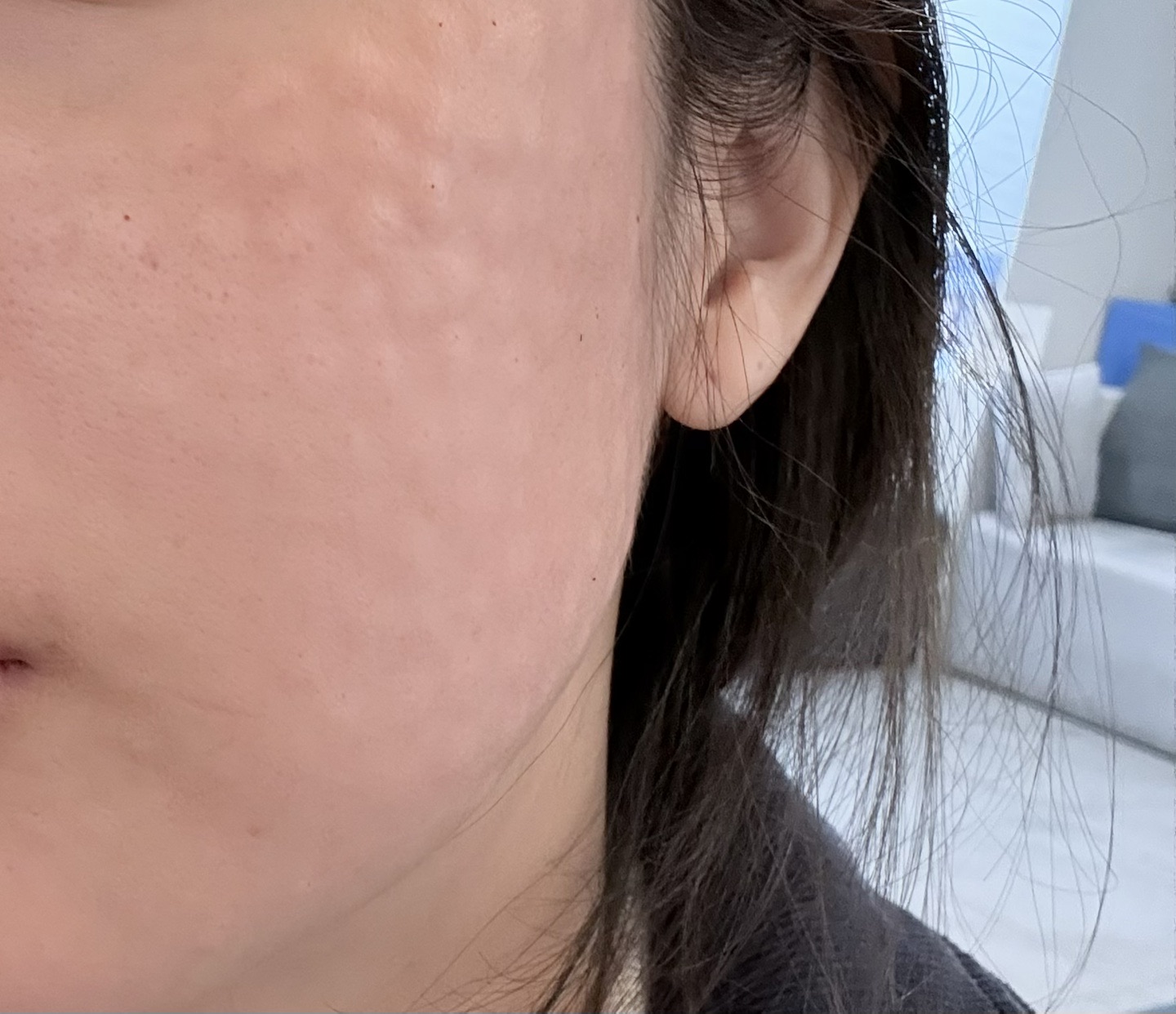 수술후기이미지