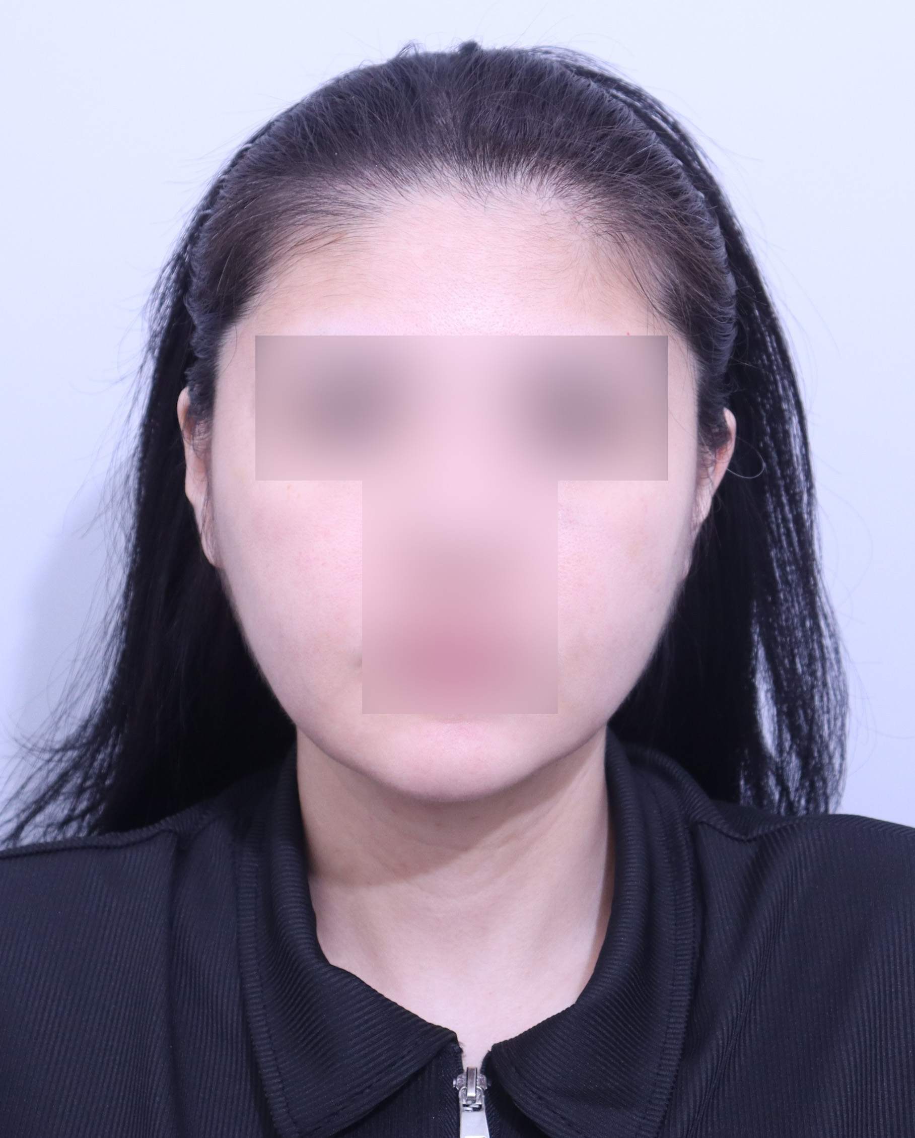 수술후기이미지