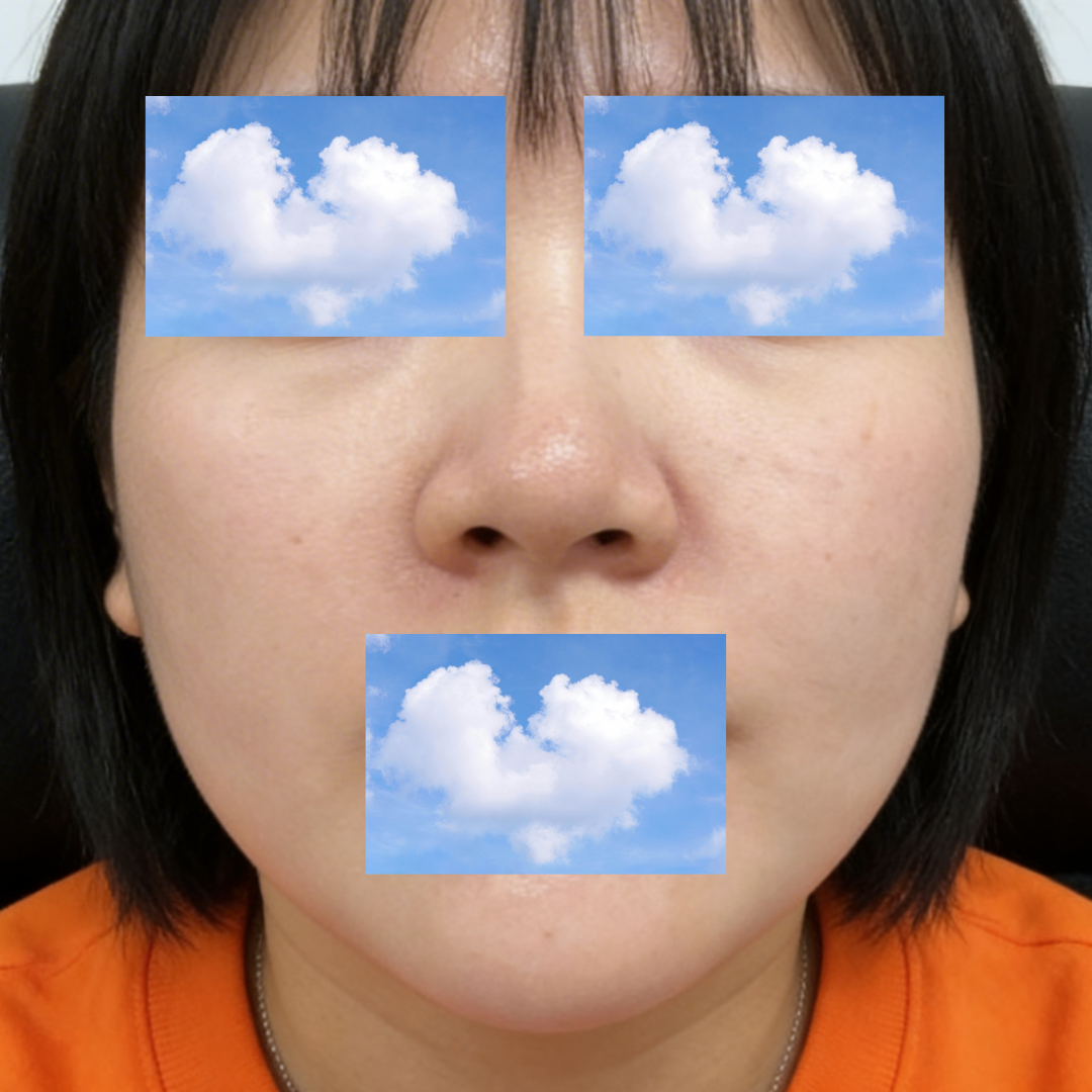 수술후기이미지