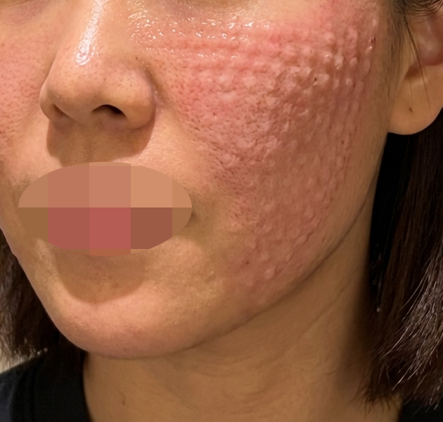 수술후기이미지