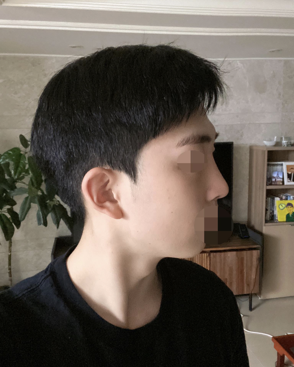 수술후기이미지