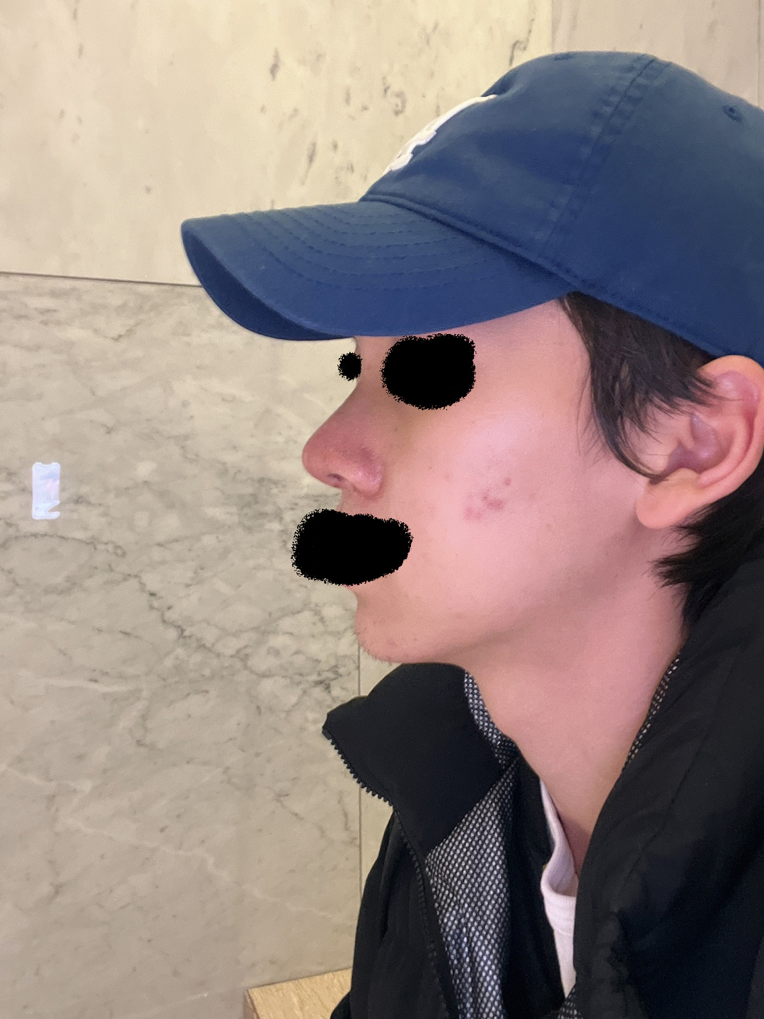 수술후기이미지