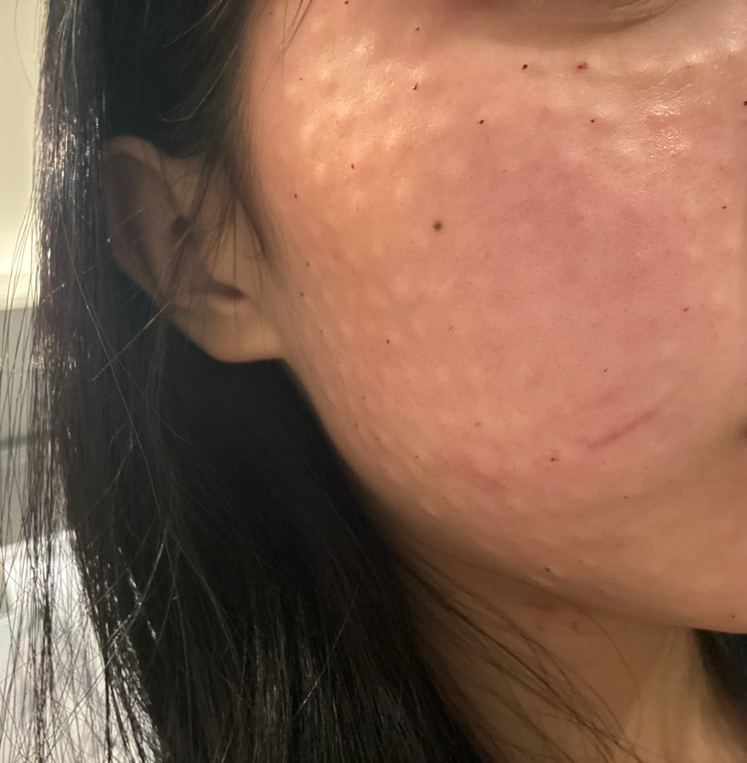 수술후기이미지