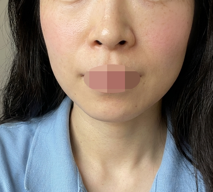 수술후기이미지