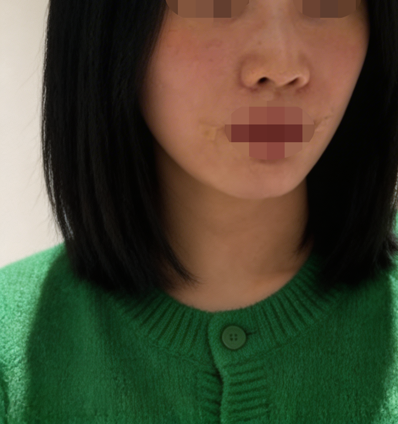 수술후기이미지