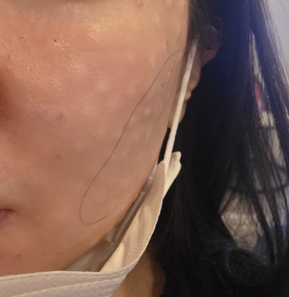 수술후기이미지