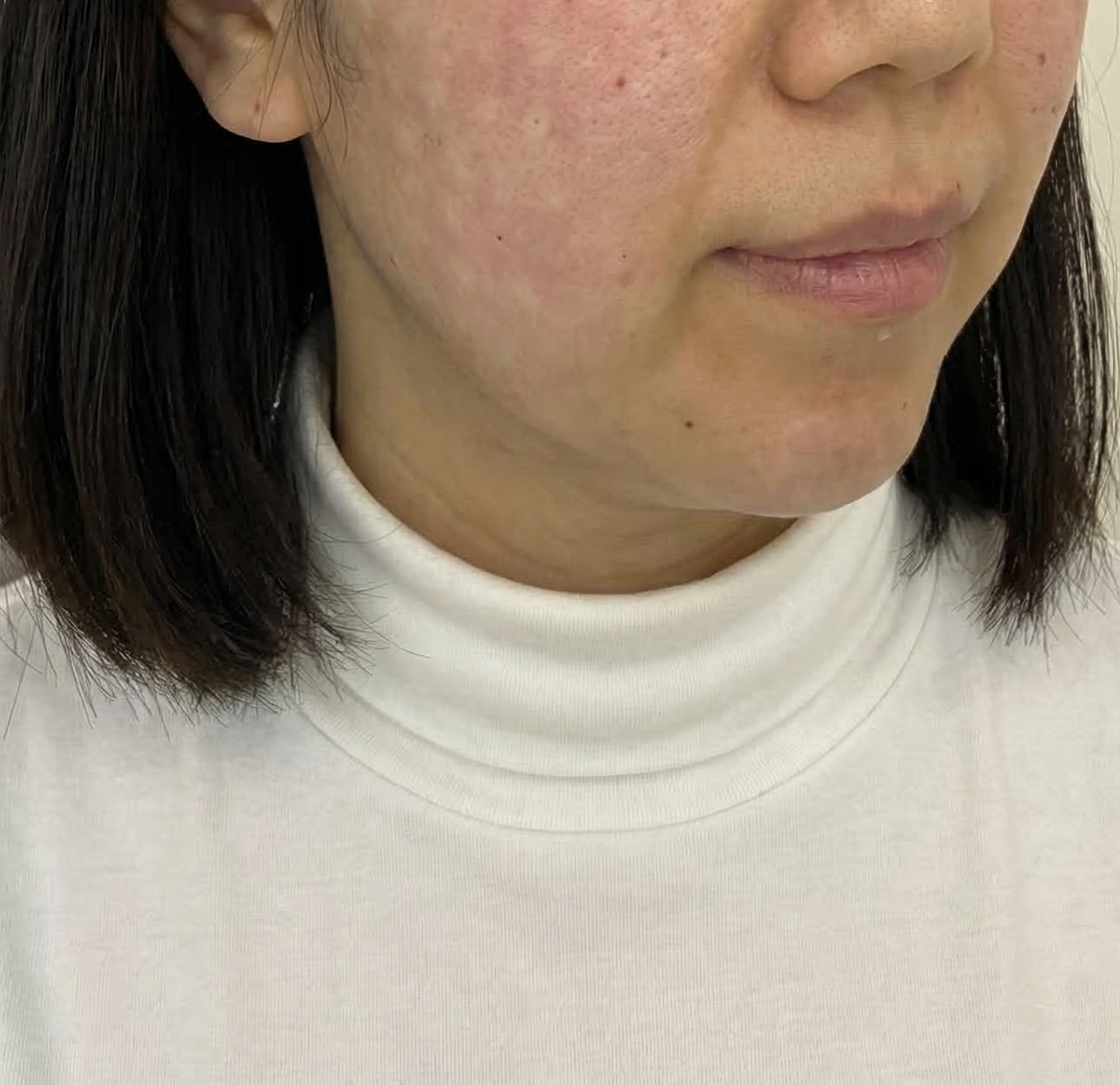 수술후기이미지