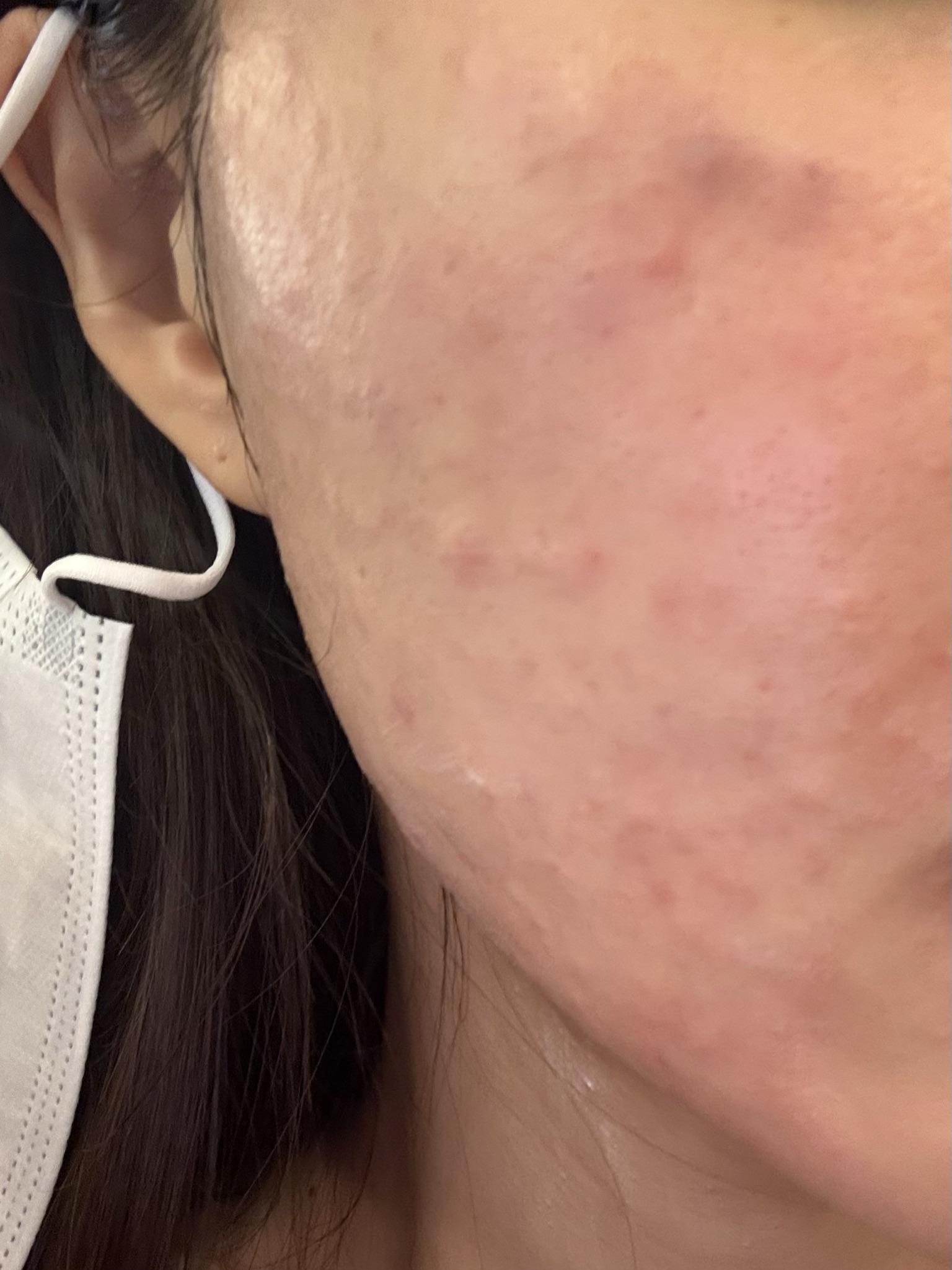 수술후기이미지