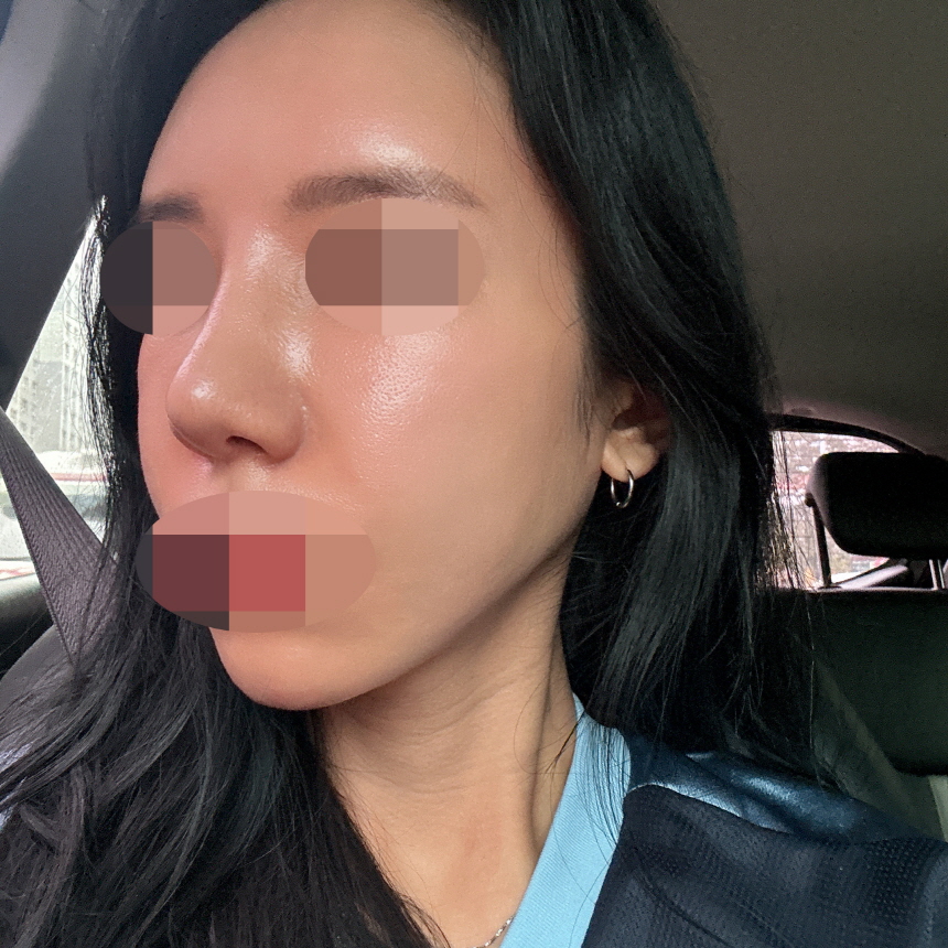 수술후기이미지