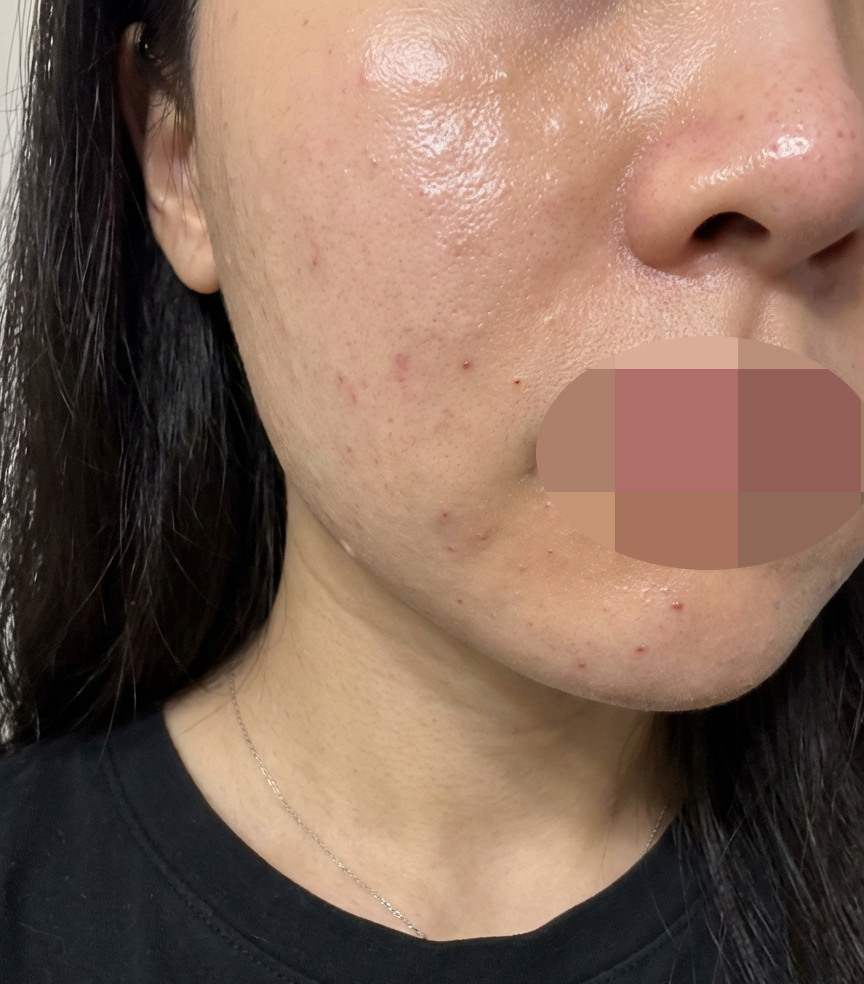 수술후기이미지