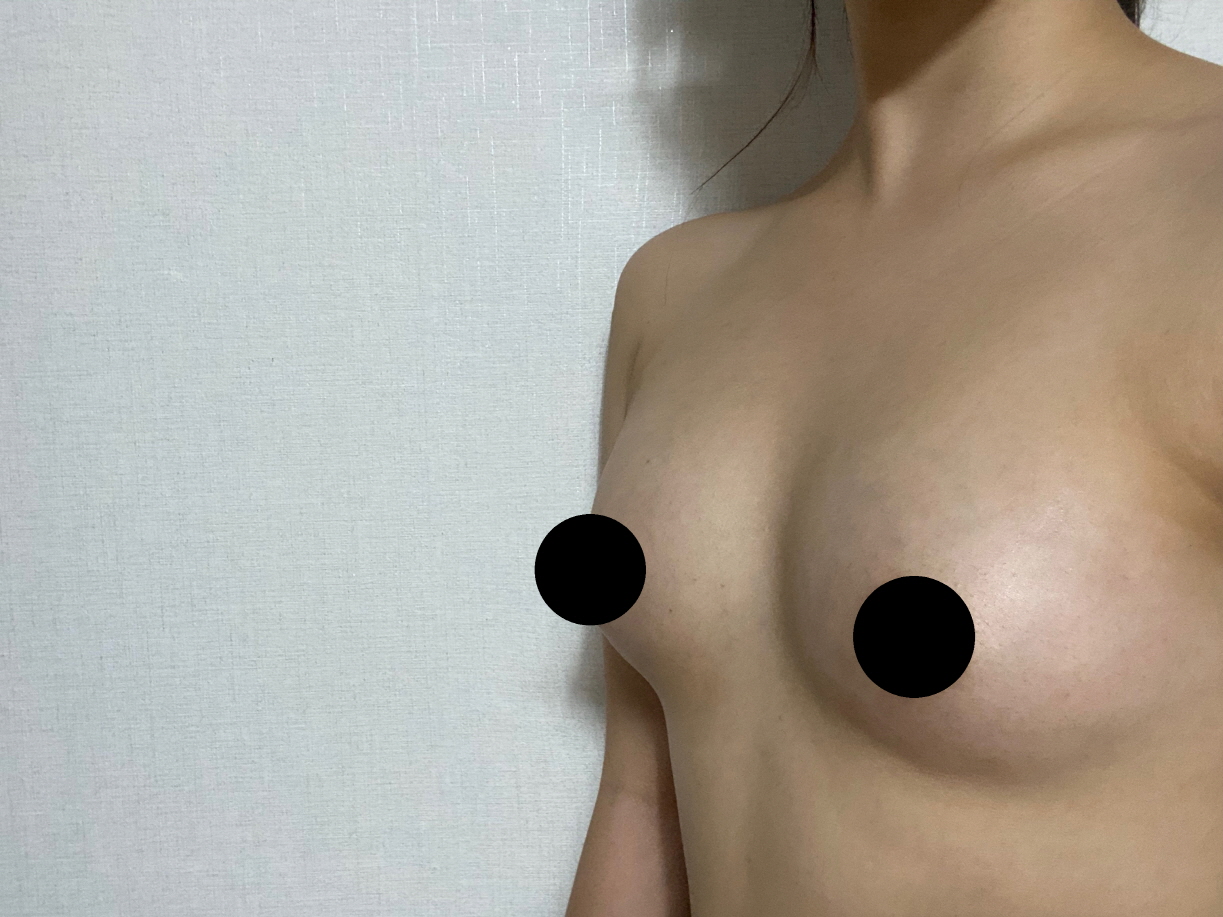 수술후기이미지