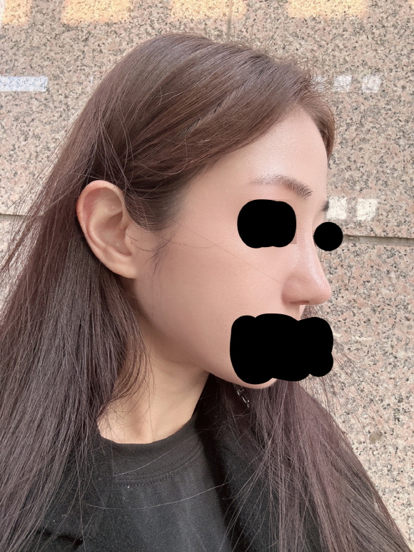 수술후기이미지