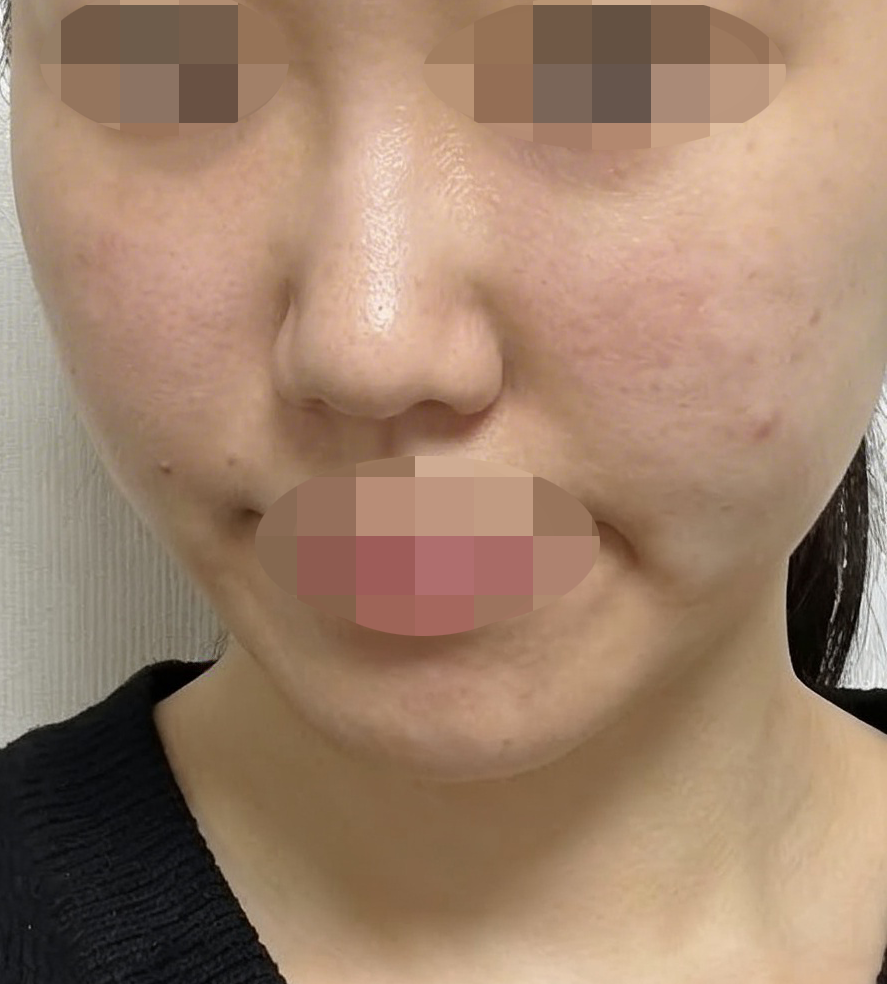 수술후기이미지