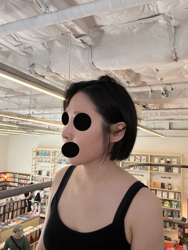 수술후기이미지