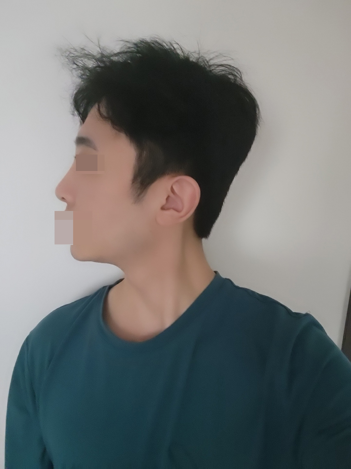 수술후기이미지