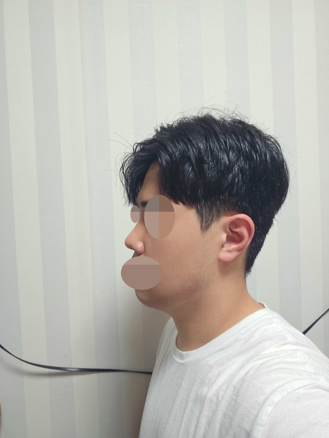 수술후기이미지