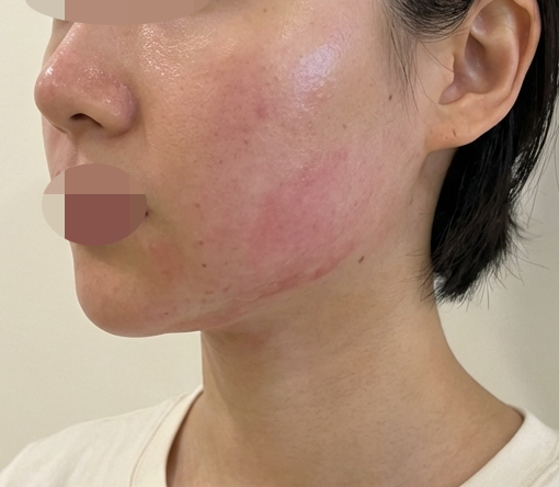 수술후기이미지