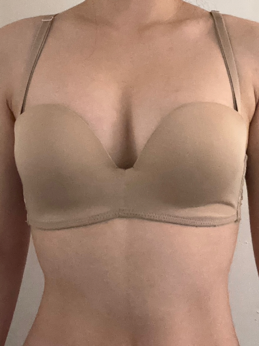 수술후기이미지