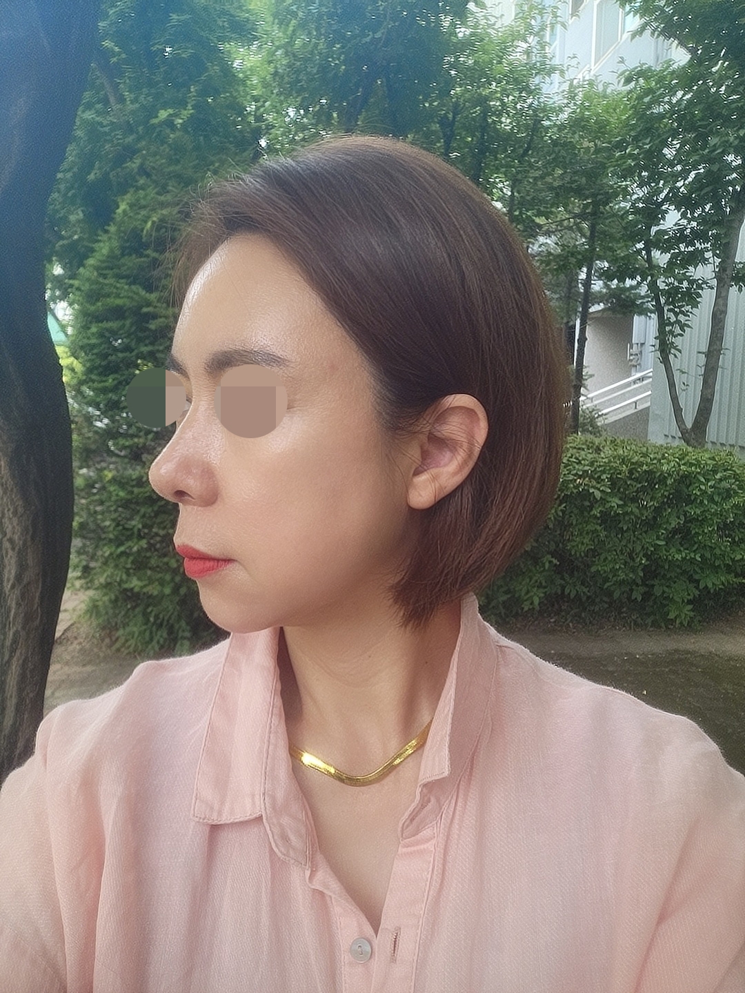 수술후기이미지