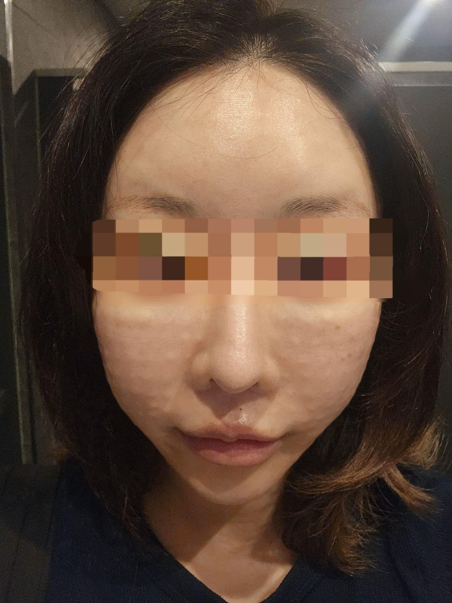 수술후기이미지