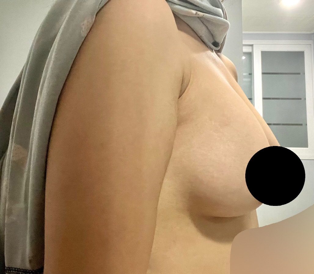 수술후기이미지