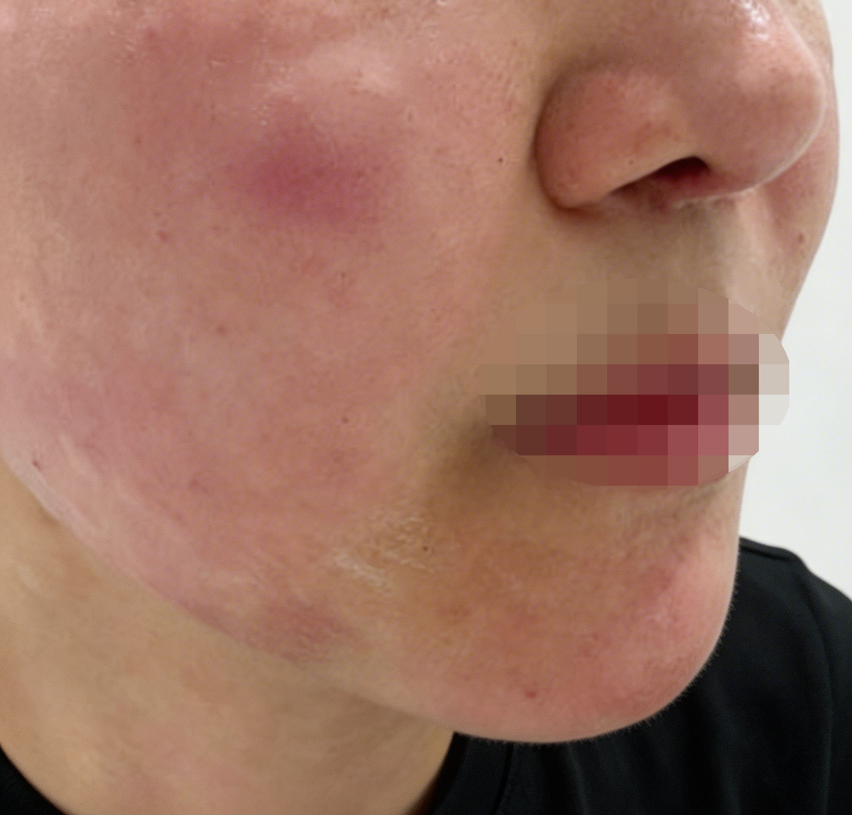 수술후기이미지