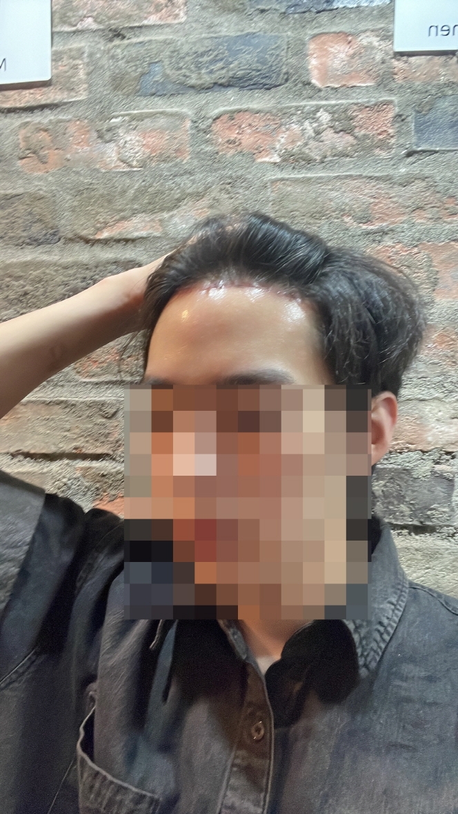 수술후기이미지