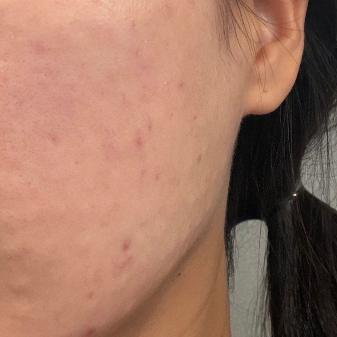 수술후기이미지