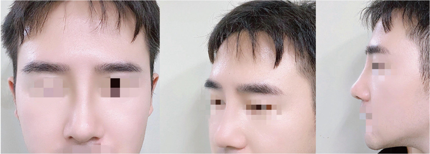 수술후기이미지