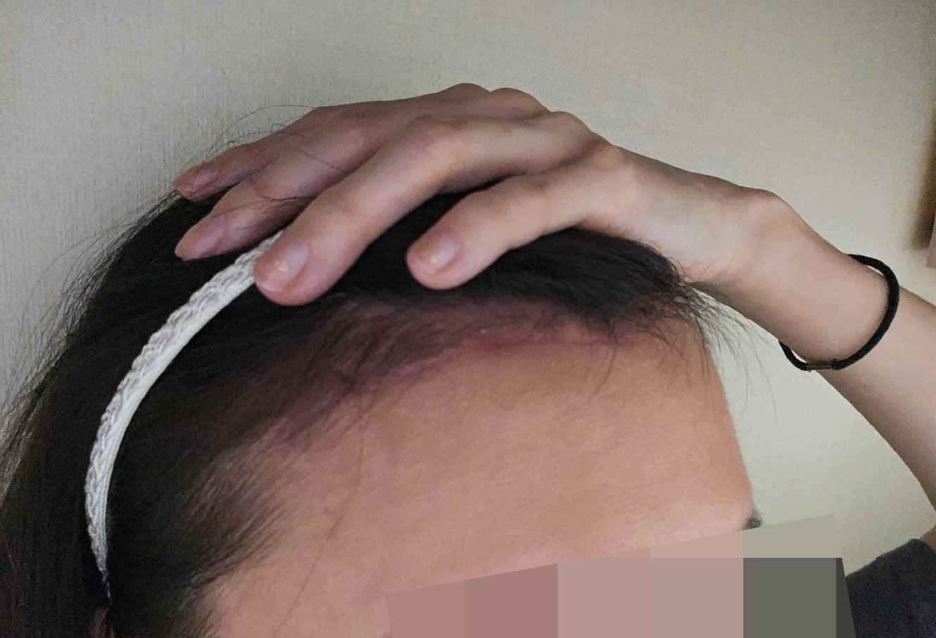 수술후기이미지